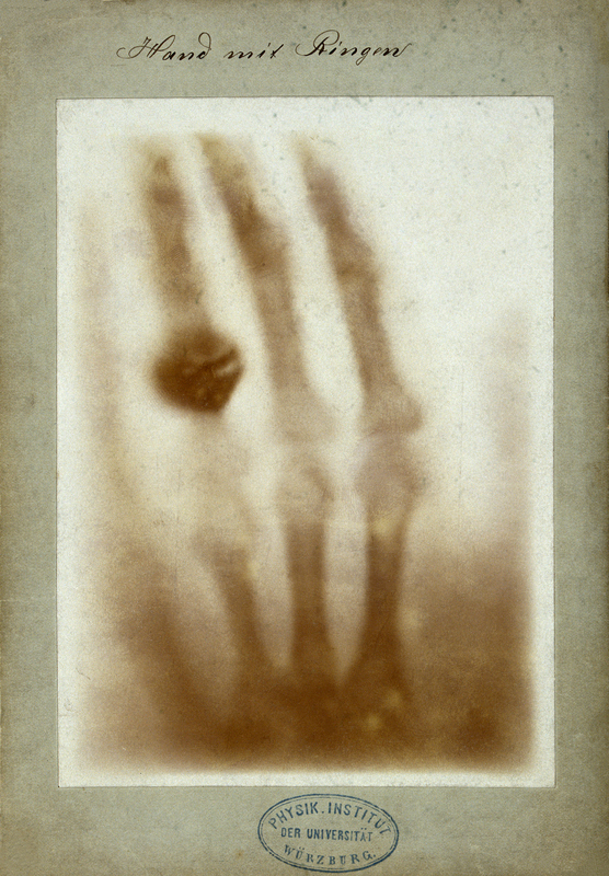 Hand mit Ringen