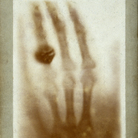 Hand mit Ringen